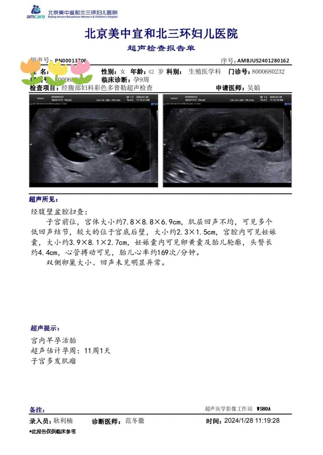 武汉为逝者放生（武汉芦丁鸡如何放生最安全）