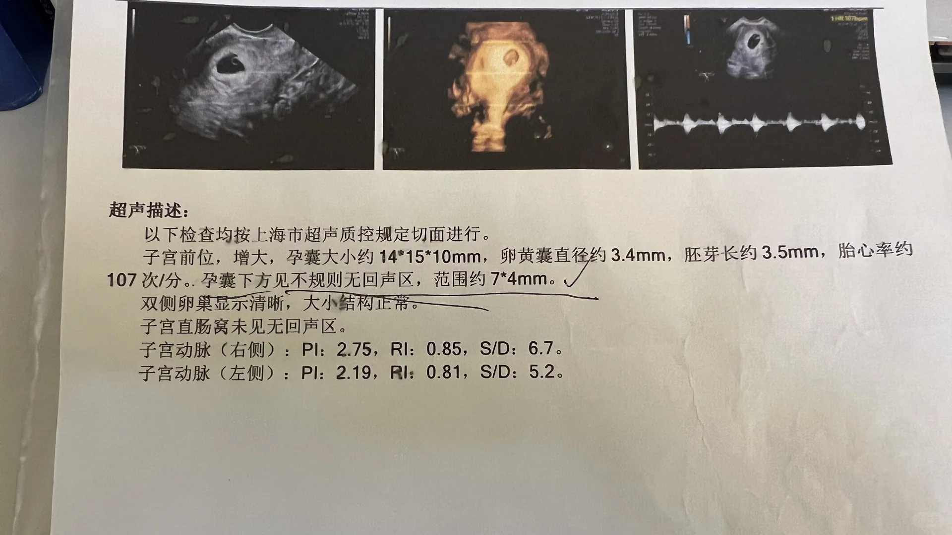 打胎了放生什么最好，方舟手游怎么放生恐龙