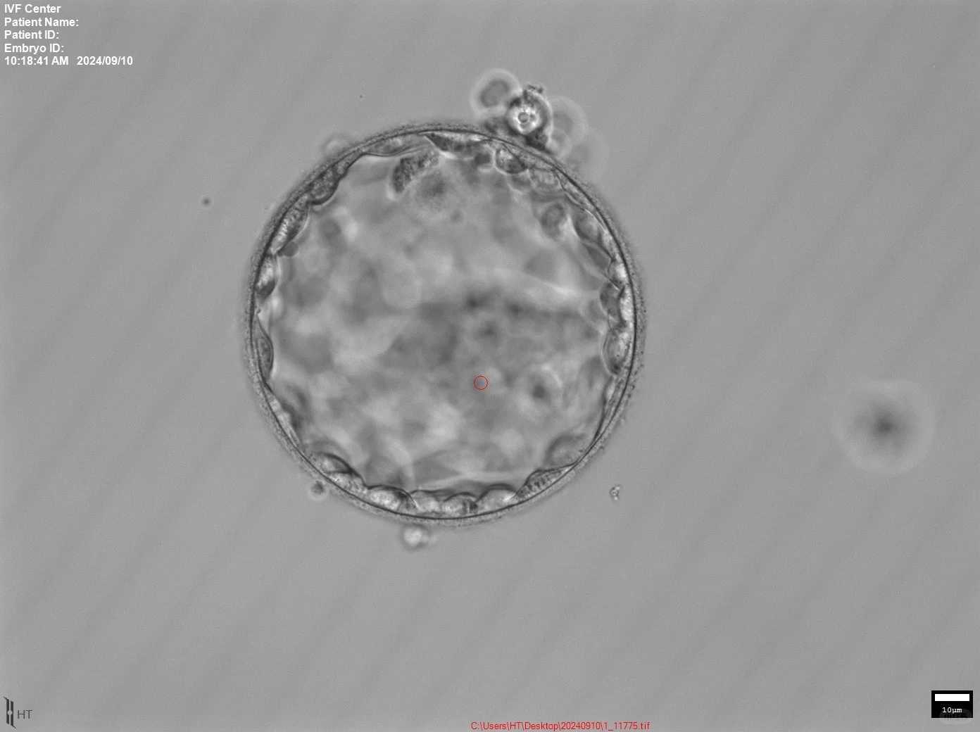 四川,鳝鱼代放生,佛教放生泥鳅代表什么