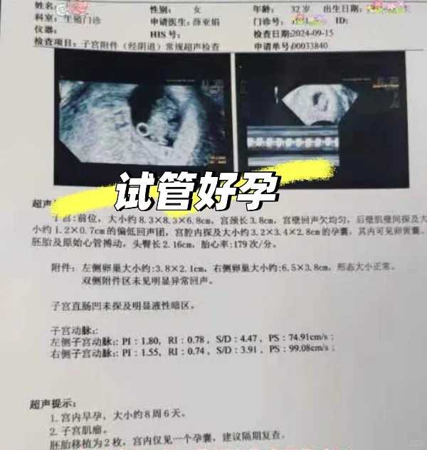 石家庄，代放生甲鱼功德，市场买的泥鳅可以放生吗