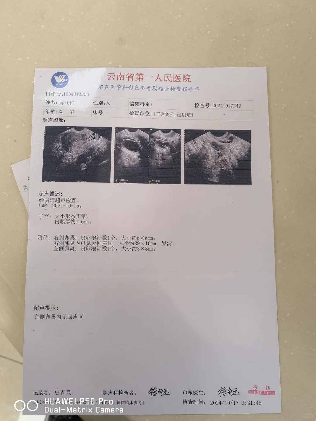 洛阳放生鱼如何钓,洛阳哪里有放生的地方,洛阳放生鱼哪里买