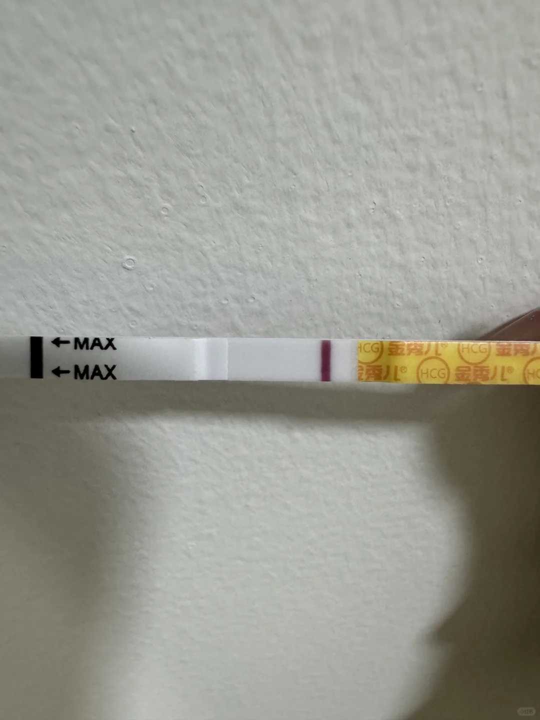 上海今年涉外首例造血干细胞捐献完成