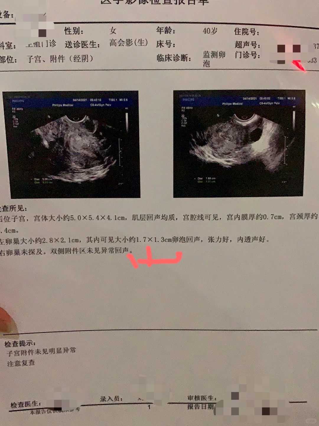 山东，代放生行为，过生日这一天放生有什么讲究吗