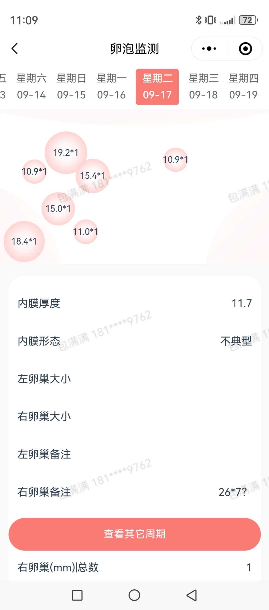 放生款为什么不能乱用，金鱼生病了放生可以吗