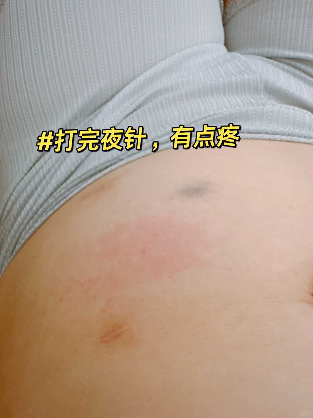 湖北把动物放生在什么时候放最合适,把动物放生在什么时候放最合适,湖北野鸡