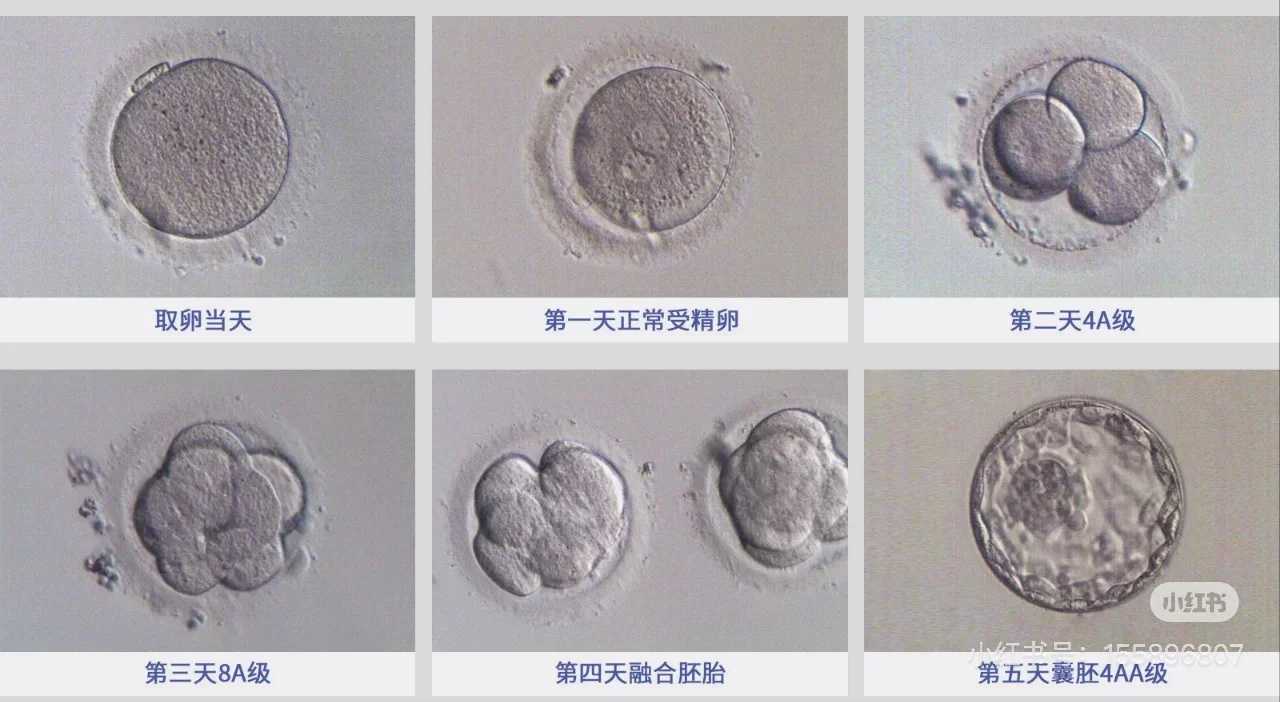 放生兔子的功德，放生---从福德到功德